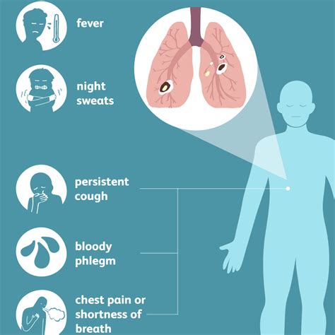 bad tb|Signs and Symptoms of Tuberculosis 